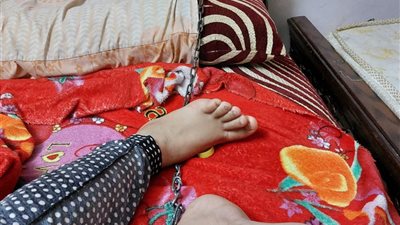 بعد نشر القاهرة 24.. مطالب بإنقاذ طفلة مصابة بضمور في المخ من والدتها بعد تقييدها بسلاسل حديدية 