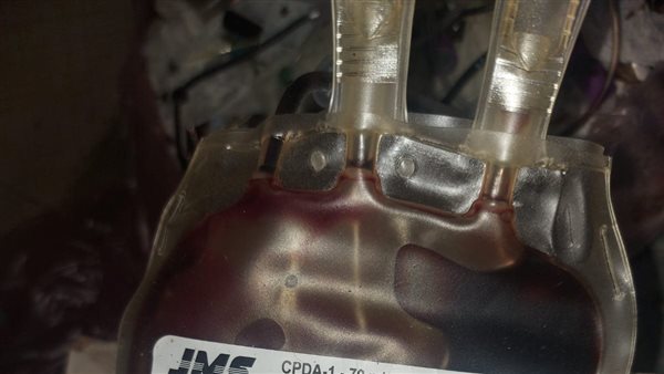 الدم المضبوط