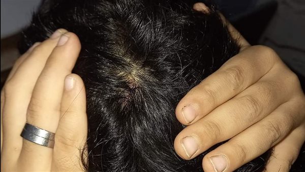 الطالب أنس أيمن 