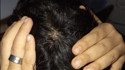 بعد نشر القاهرة 24 | المدرس المتهم بالاعتداء على طالب ببورسعيد يعتذر إليه في منزله.. ووالده: تنازلنا عن المحضر