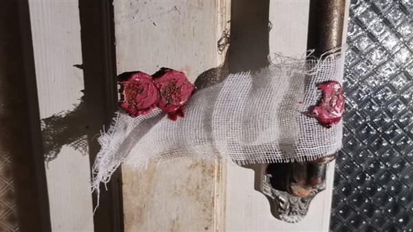 تشميع منشآت طبية