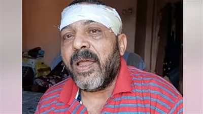 الأب حاول إنقاذ ابنته من اعتداء زوجها فأصابه في رأسه