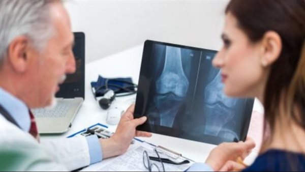 هشاشة العظام عند