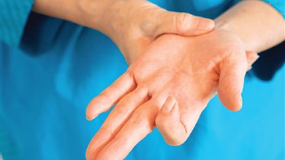 الإصبع الزناد علامة على الإصابة بالسكري | دراسة