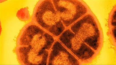 الميكروبات يمكن أن تعيش في المريخ لملايين السنين | أعرف التفاصيل