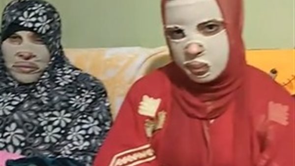 إسراء ضحية تشويه