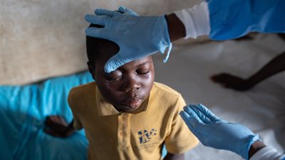 الهلال الأحمر تحذر من نقص لقاحات جدري القرود في إفريقيا