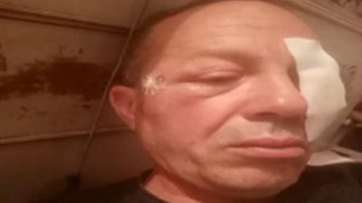 سائق قطار الدقهلية يروى تفاصيل الاعتداء عليه بالحجارة | فيديو