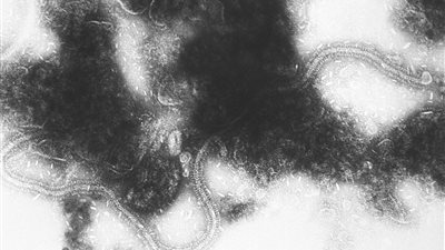 الولايات المتحدة تصدر لقاحها الأول للفيروس التنفسي المخلوي بحلول الخريف المقبل