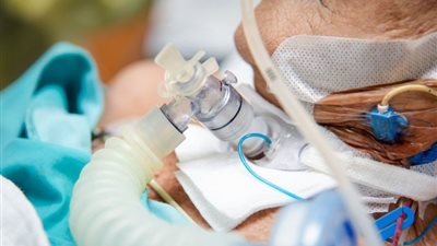 أمريكا تعاني من نقص أنابيب القصبة الهوائية.. والخبراء يوصون بإعادة الاستخدام