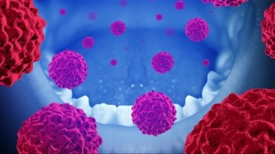 Oral Health Foundation: ارتفاع معدلات الإصابة بسرطان الفم بنسبة 36% عن العام الماضي