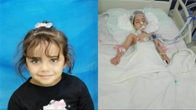 أنقذوا جانيت تامر.. إصابة طفلة ببكتريا في المخ بعد تعرضها لـ عضة كلب ضال بمدينة نصر