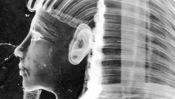 توت عنخ آمون 