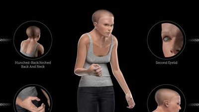 أحدب بـ عنق عريض.. نموذج مرعب يكشف تأثير استخدام التكنولجيا على شكل الإنسان عام 3000
