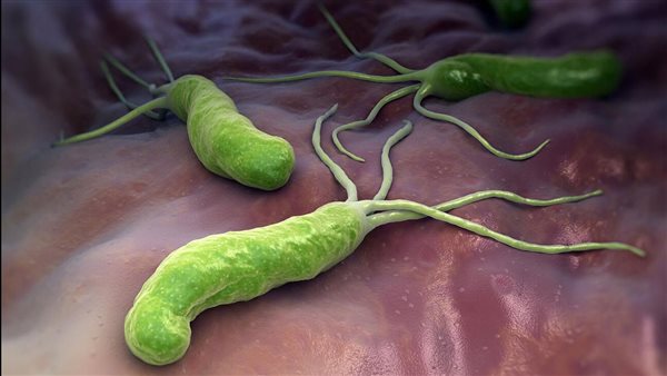 جرثومة المعدة -تعبيرية