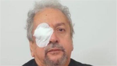 بعد إجرائه عملية جراحية.. عمر عبد العزيز: كل الشكر للطبيب الذي أنقذ عيني من الانفصال الشبكي