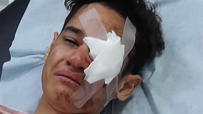 الجالية المصرية تشكر الجهات الأمنية بالقصيم لسرعة ضبط المعتدين على الطالب المصري