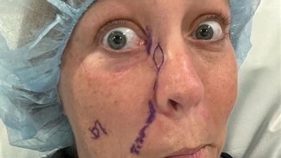 عن طريق صورتها على فيسبوك.. سيدة تكتشف إصابتها بالسرطان بأكثر الطرق غرابة