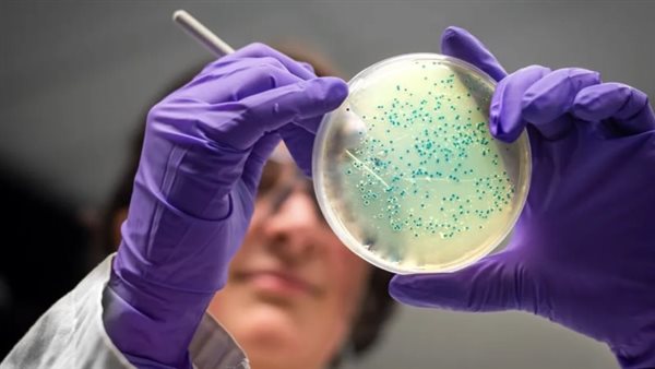 مرض الليستريا