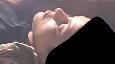 أسرتها عرفت من الفيس بوك.. إصابة فتاة صدمتها سيارة مسرعة ببورسعيد