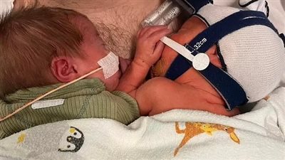  أسترالية تلد توأمًا على جانب الطريق السريع بعد تعثر الإسعاف في الوصول إلى المستشفى