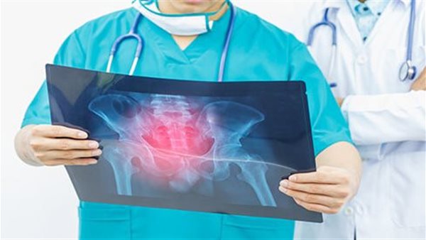 أشعة - أرشيفية