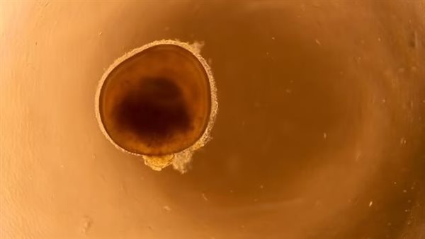 شبكية عين اصطناعية