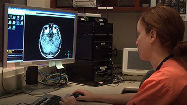 الصداع النصفي