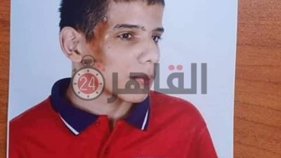والدة طالب من ذوي الاحتياجات الخاصة تستغيث بالرئيس بعد حرق ابنها بمدرسة في أسيوط