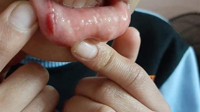 فتح له فمه.. وكيل مدرسة يضرب طالبًا بالفيوم بسبب “كراسة” (صور)