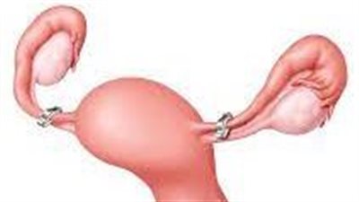 ما حكم ربط المبيضين لمنع الحمل بأمر الطيبب؟.. الإفتاء ترد 