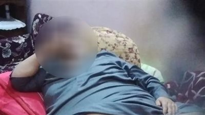 نفسي أدخل الحمام زي الناس.. شاب بالغربية وزنة 350 كيلو يعاني من مرض الفيل