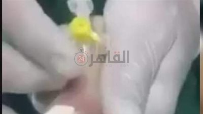 مدير مستشفى أبو قرقاص يكشف حقيقة واقعة ممرضين تراهنوا على وضع الكانيولا لطفل رضيع | تفاصيل
