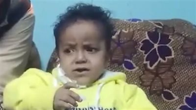 كوكسال بابا أسوان يخطف القلوب بخفة دمه.. ووالدته: محتاج زراعة كلى وحالتنا متسمحش نعالجه | بث مباشر