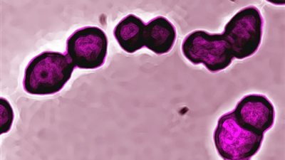 وفاة 7 أطفال متأثرين بعدوى بكتيرية منتشرة في بريطانيا