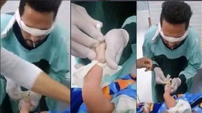 بيركب كانيولا لرضيع وهو مغمض.. تفاصيل واقعة ممرض أبو قرقاص وغلق وحدة حضانات خاصة | بث مباشر