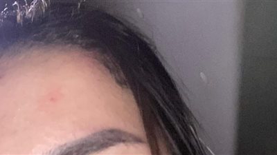 طالبة تتهم سيدة بالتعدي عليها بالضرب داخل سيارة أجرة بالمنوفية