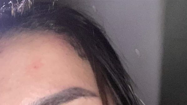 الطالبة المعتدى عليها