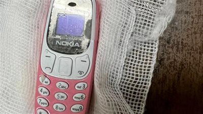 استخراج هاتف محمول من معدة شاب بمستشفى الطوارئ الجامعي بطنطا | صور