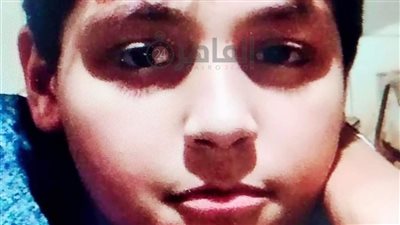 دخل يجبس دراعه خرج ميت.. أسرة صغير تتهم أطباء بمستشفى طنطا الجامعي بالتسبب في وفاته