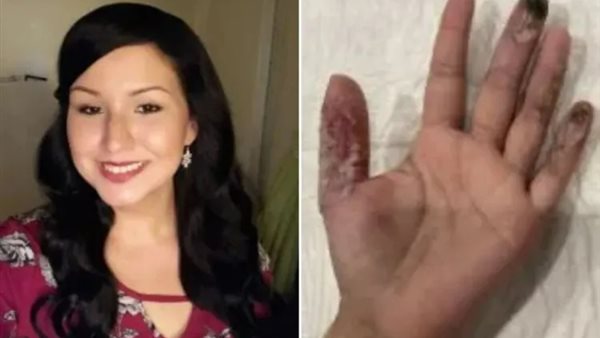 عملية تجميلية