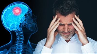 الضباب الدماغي.. كيف تؤثر كورونا على الذاكرة؟