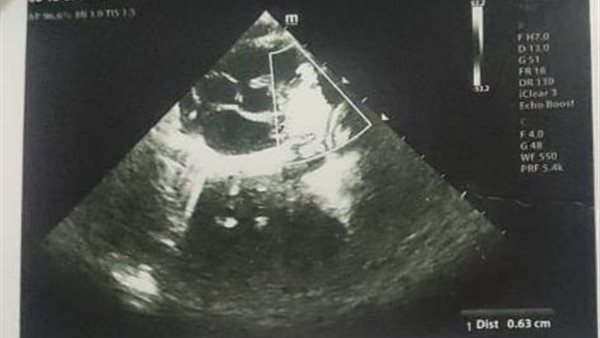 التقارير الطبية لماريا