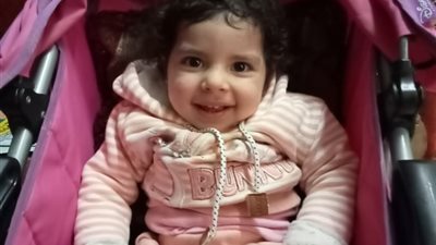 طفلة بحجم كف اليد | أناسيمون تواجه الضمور العضلي.. والأم تستغيث: حالتها بتتدهور لازم تأخد الحقنة بسرعة