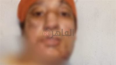 ننشر صور سيدة أشعل زوجها النيران بها لرفضها تعاطيه الإستروكس بكرداسة 