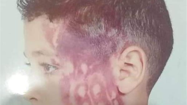 الطالب المعتدى عليه