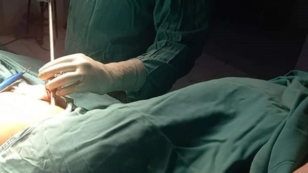 إجراء جراحة لتفريغ