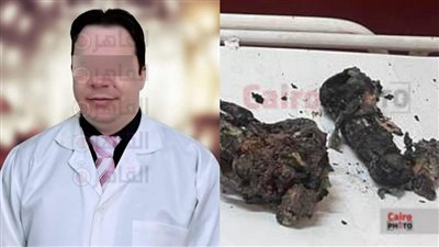 أجنّة محترقة وأخرى مشوهة.. طبيب الإجهاض بكرداسة: بخلص العالم من أطفال مشردة