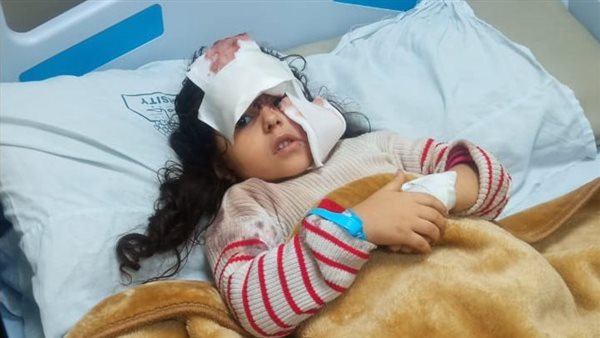 الطفلة المعقورة بمسطرد