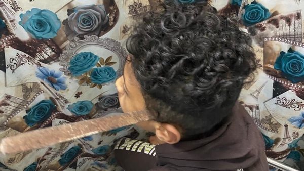 الطفل المصاب